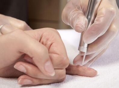 Lazerio terapijos atlikimas